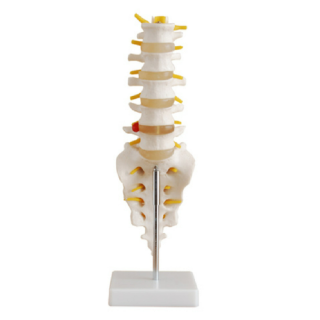 Life-Size Lumbar Vertebrae with Sacrum & Coccyx and Herniated Disc