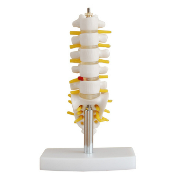 Mini Lumbar Vertebrae with Sacrum & Coccyx and Herniated Disc