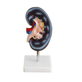 Kidney Model 1 Part