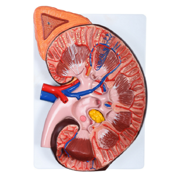 Enlarged Kidney Model 1 Part