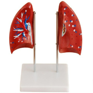 Lung Model