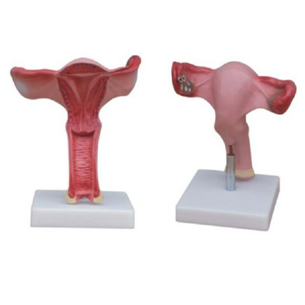 Magnified Uterus Model