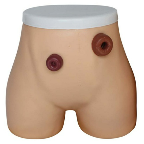 Ostomy Nursing Model