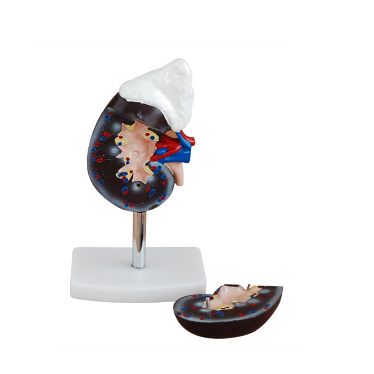 Human Kidney with Adrenal Gland - Image 2